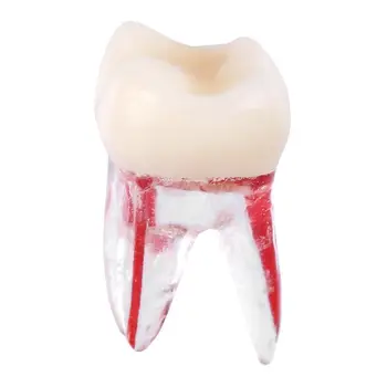 1:1 Smolo Zobni Endodontic Zob Model Z Barvnim Root Canal in Celuloze Model Zobozdravnik Orodja za Študentske Študijski Praksi 1pc