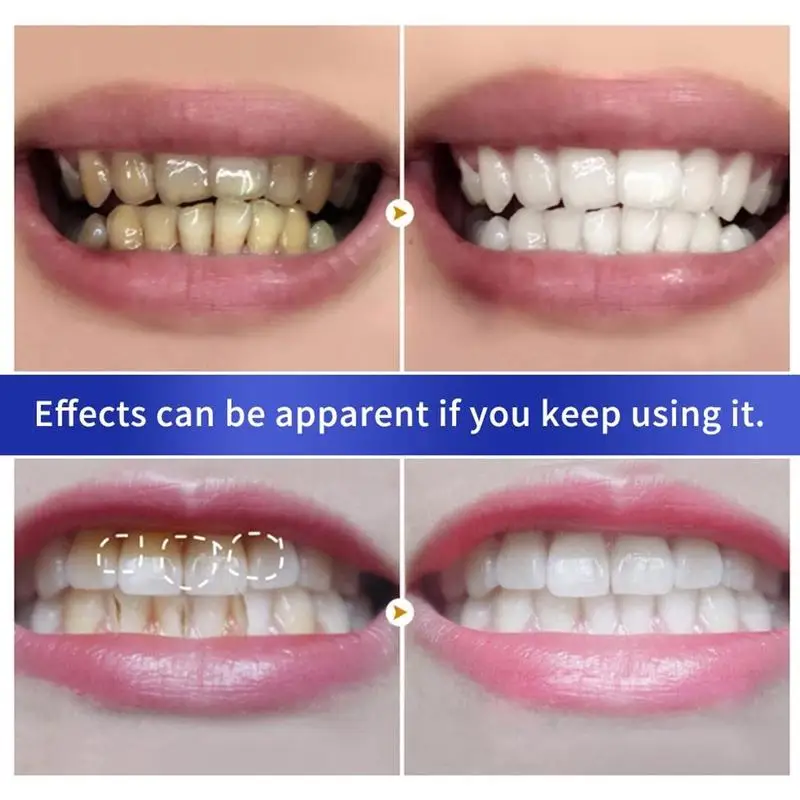 Beljenje Sadno zobna pasta Odstranite tartar Čiščenje Madežev Zob Prahu Sveže Ustno Higieno Dih Zmanjšanje zobnih Oblog Zobni Tablet